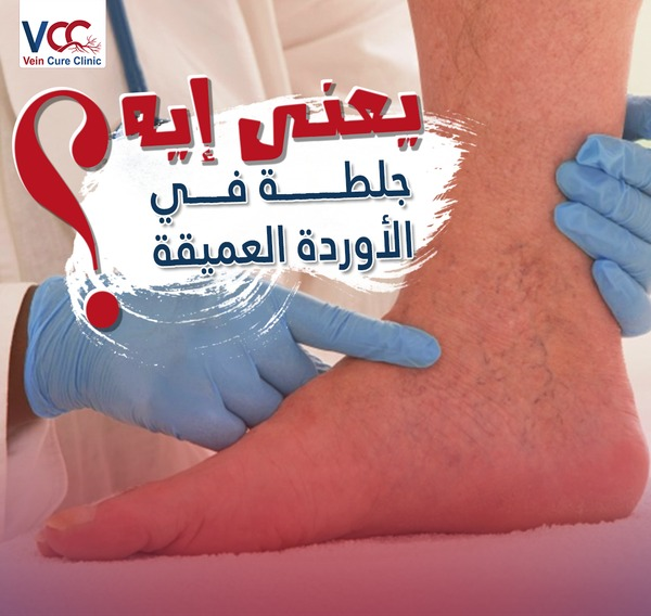 What does a deep vein clot mean?!