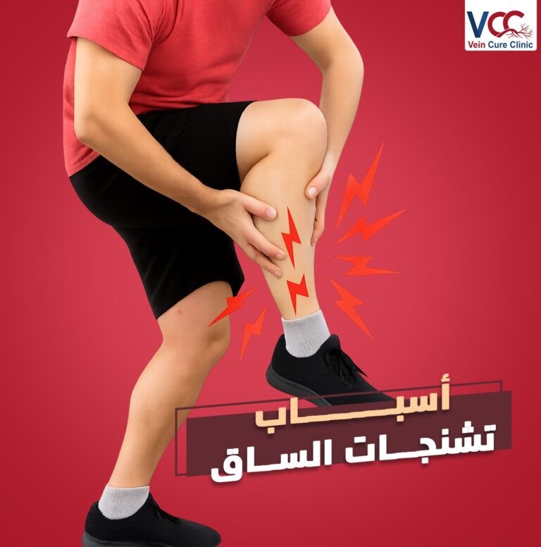 اتعـــــرف علي أسبـــــاب تشنجات الساق