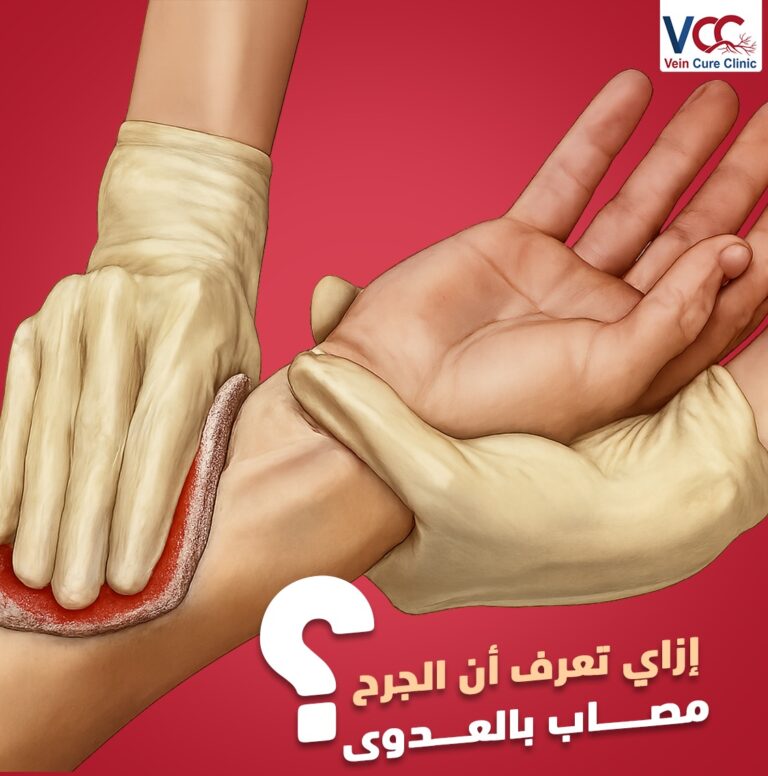 إزاي تعرف أن الجرح مصــــاب بالعــــدوى ؟