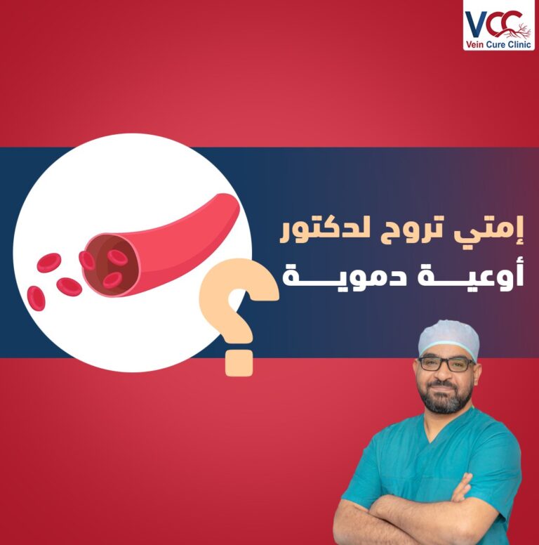 إمتى لازم تزور دكــتور أوعيـــة دمويــة؟ 👌