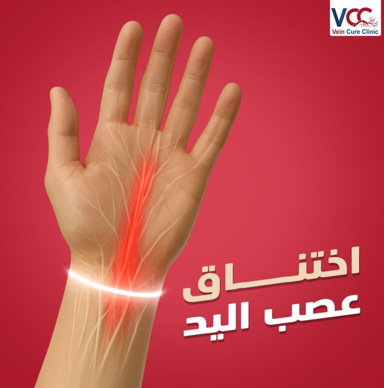 سمعت قبل كده عن اختناق في عصب اليد؟