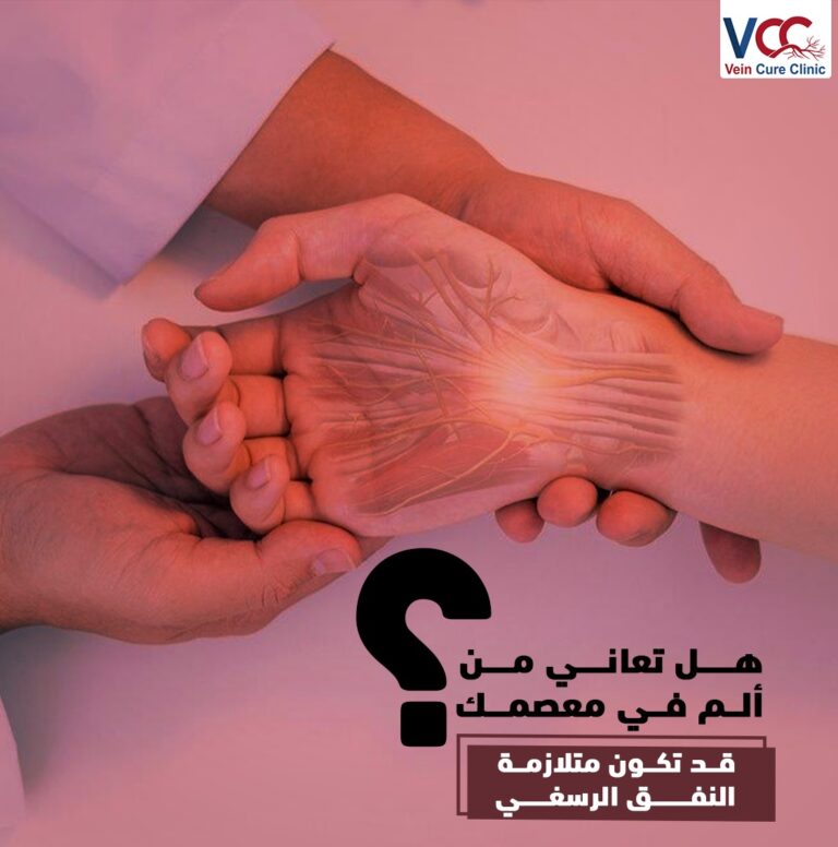 بتعاني من ألم في المعصم.. ممكن تكون متلازمة النفق الرسغي