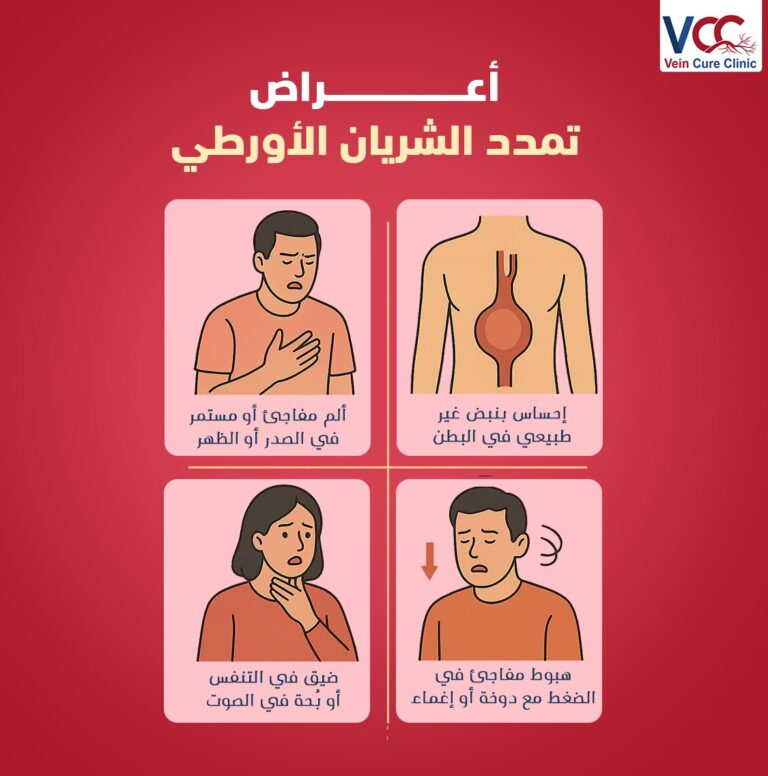 مضاعفات ممكن تحصل لو أهملنا علاج تمدد الشريان الأورطي
