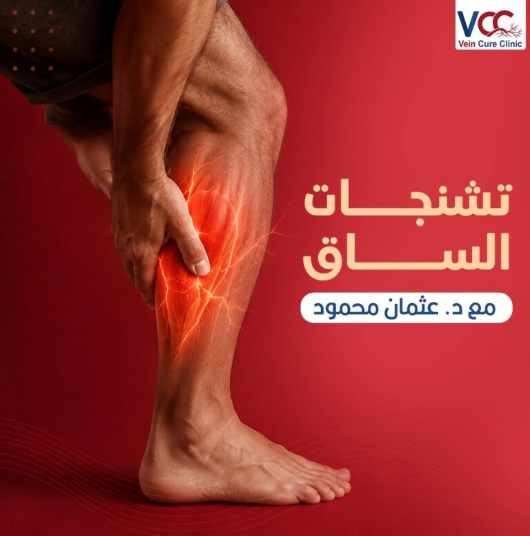 تشنجات الساق مع د. عثمان محمود