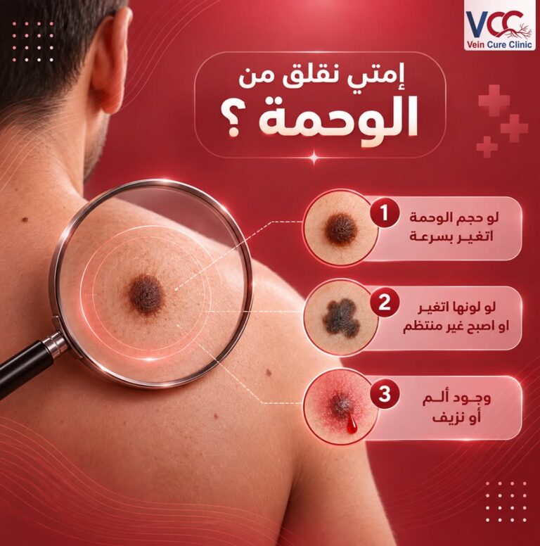 إمتى نقلق من الوحمة ؟