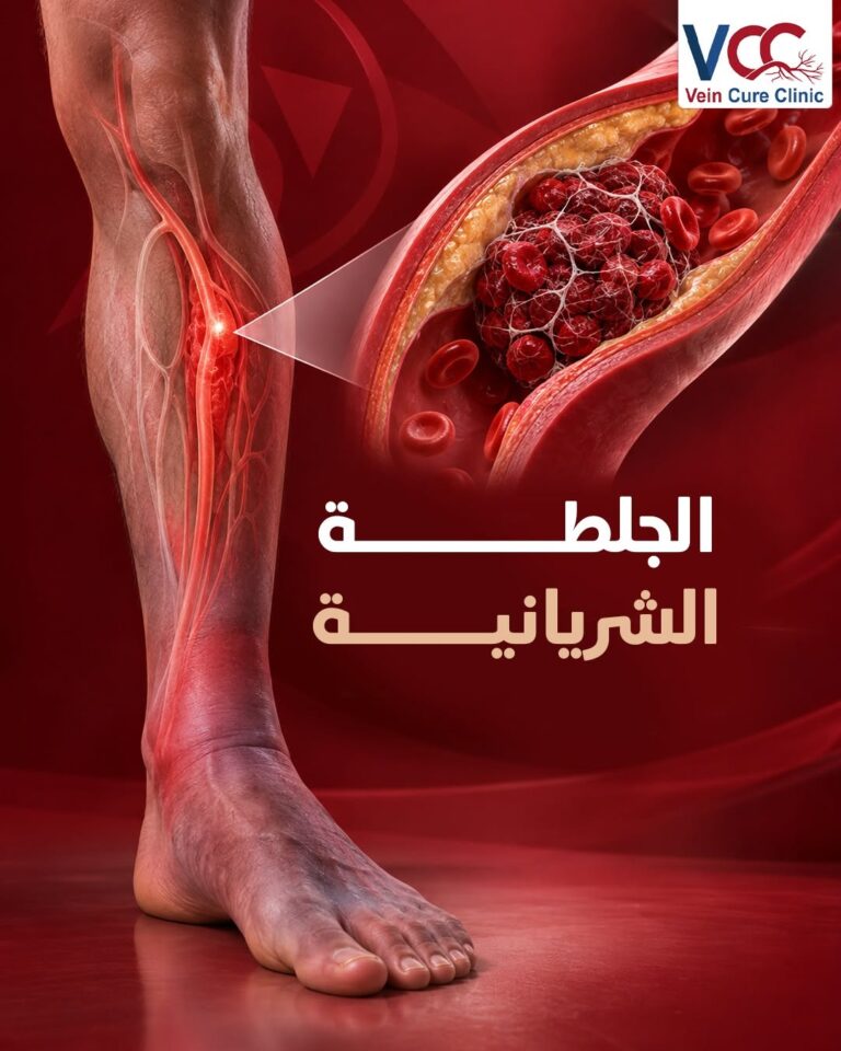 الجلطة الشريانية مع د. عثمان محمود